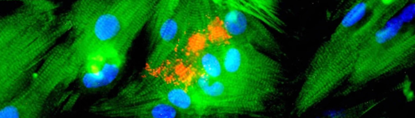 Cardiomyocytes developed in culture from neonatal mouse heart, stained with anti-sarcomeric myosin