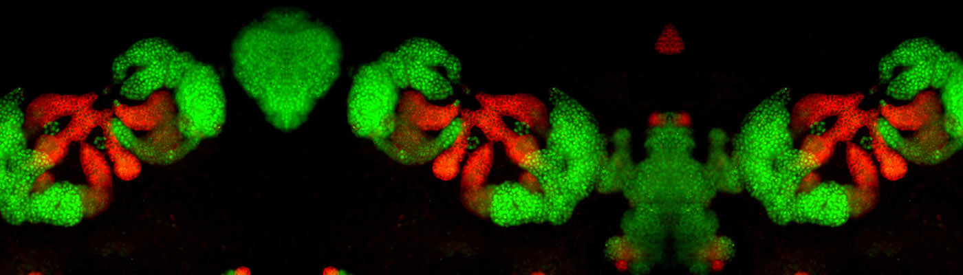 iPSC derived kidney organiod.