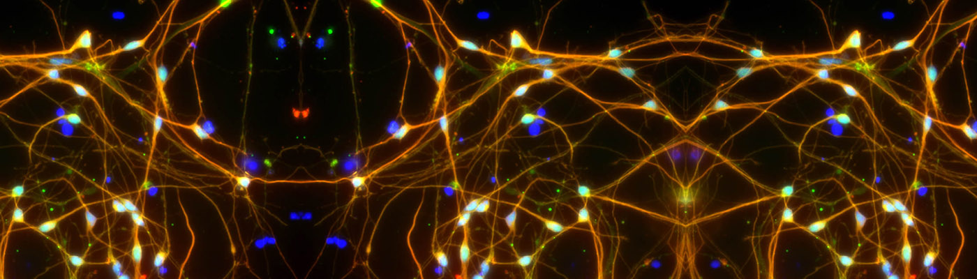 Neurons derived from patient specific iPS cells